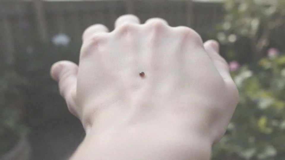 Nie wyciągnięta drzazga – zagrożenia i metody usuwania